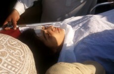 Pakistan medics remove bullet from shot child activist
