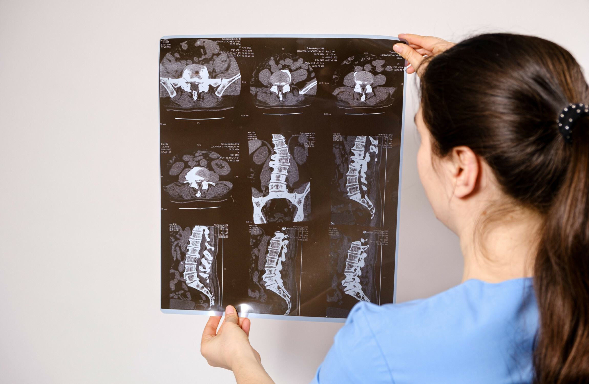 Pledge made 7 years ago that children wouldn't wait on scoliosis surgery has been broken, Dáil hears - Vimarsana News