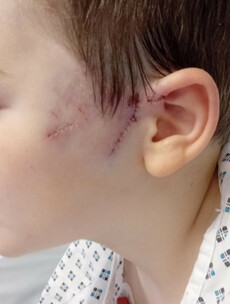 'The dog tore the face off him': Father of boy savaged by dog speaks of Limerick park attack