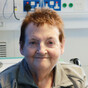 Galway woman becomes country’s first patient fitted with heart-failure sensor