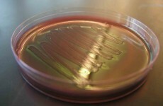 At least 49 cases of E.coli after outbreak at Belfast restaurant