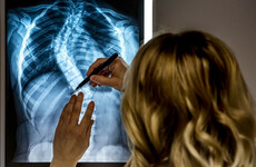 Harris and Donnelly to meet representatives for children on waiting lists for spinal surgeries