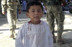 Suicide bomber kills 36 in Afghanistan