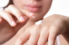 'Living with Psoriasis' conference to give practical advice to sufferers