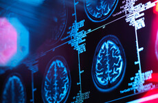 Sitdown Sunday: His genes meant he should've developed Alzheimer's 25 years ago. Why hasn't he?