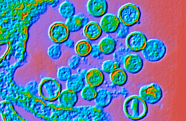 Hantavirus: What to know about the potentially fatal disease and the outbreak on a cruise ship