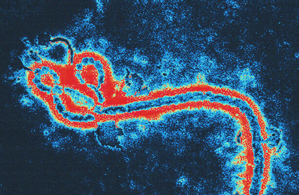 Amid outbreaks, an age-old theory is being resurrected online: viruses don’t exist