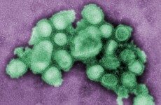 Number of swine flu deaths in Northern Ireland reaches 21