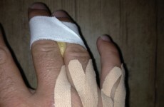 Graeme McDowell explains what really happened with his 'freak' hand injury in China