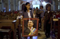 Chavez suffered 'complications' but recovering, his aides say