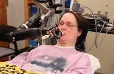 VIDEO: Quadriplegic woman powers a robotic arm with her mind