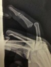 17 graphic images that prove sports injuries are worse than they sound
