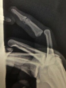 17 graphic images that prove sports injuries are worse than they sound