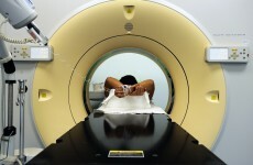 Research could predict how bowel cancer patients react to chemo