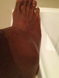 Here's what Serena Williams' ankle looked like after she got upset by Sloane Stephens
