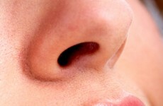 TCD researchers discover how MRSA bacterium is carried in human nose