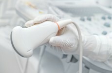 Reports on abortions over minor foetal abnormalities incorrect, says Eurocat
