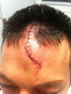 Your It's Just A Scratch Picture Of The Day