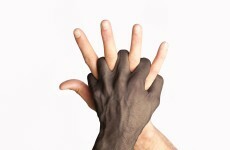 Racial profiling has 'a discriminatory effect' and should be prohibited - report