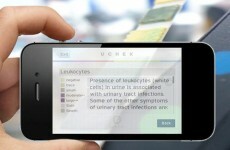 Now there's an app that analyses your pee