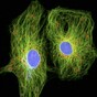 Gene test may save prostate cancer patients from needless surgery