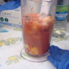 How to make a 'placenta smoothie'... like this Irish couple did