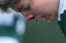 7 of the best images from the today's schools rugby action