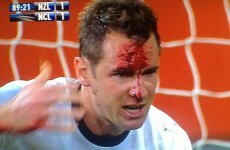 VIDEO: New Zealand's Shane Smeltz has his head busted wide open