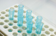 Hewlett-Packard launches free cancer screening for all employees