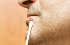 That cold sore might be causing you memory loss