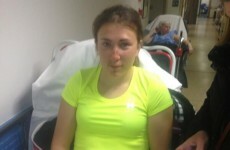 Olympic sailor Annalise Murphy crashes bike into parked car, breaks nose