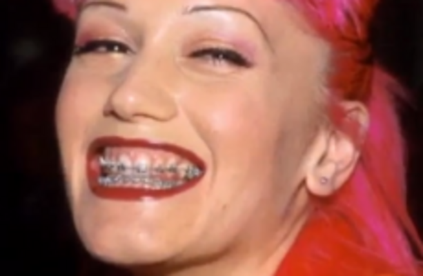7 Celebs Who Faced The Horror Of Adult Braces The Daily Edge