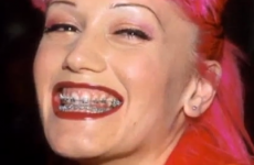 7 celebs who faced the horror of adult braces
