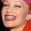 7 celebs who faced the horror of adult braces