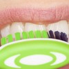 Gum disease sufferers at risk of diabetes and heart disease