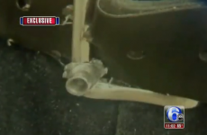 Man’s belt buckle stops a bullet and saves his life