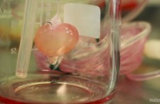 In lab 'bio-kidney' successfully transplanted into rat