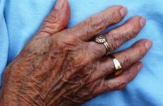 OECD report recommends mandatory pensions for private workers