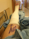 Extent of Cork’s Paudie O’Sullivan injury confirmed – broken fibula and tibia