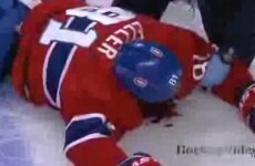 A brutal and illegal hit left a hockey player in a pool of blood last night