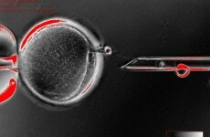 Scientists create human stem cells by cloning for first time