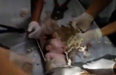 Newborn baby survives after being 'flushed down toilet'