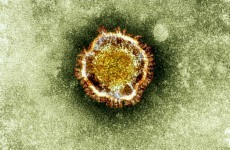 SARS-like virus claims 65-year-old French victim