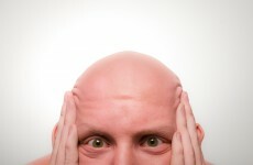 Men are more worried about going bald than finding a wife