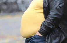 How poor countries are now facing obesity epidemics