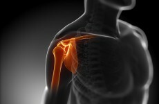Osteoporosis drug aids young people with CF not helped by standard treatments