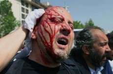 Turkey: Deputy PM apologises for violence against protesters