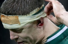 'He could have been dead 10 minutes later' - Chris Nowinski on BOD blow against France