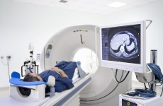 Irish men more likely to get cancer and die from it than women
