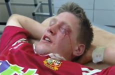 The best and bloodiest bits from the Lions last battle with the Waratahs